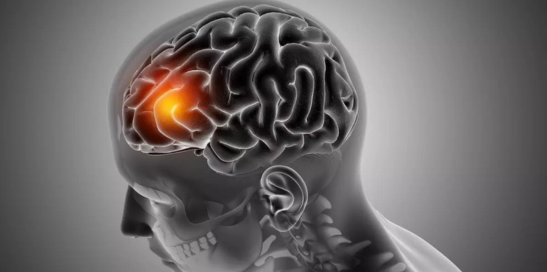 Tratamento Inovador Elimina Tumor Cerebral Sem Efeitos Colaterais